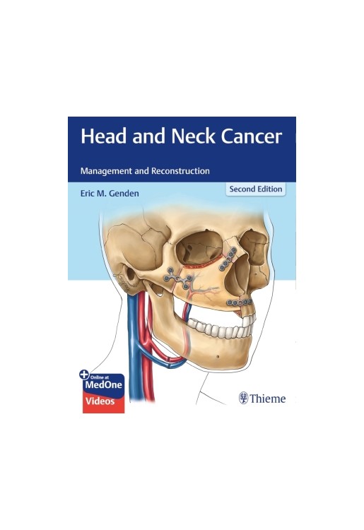 Head and Neck Cancer