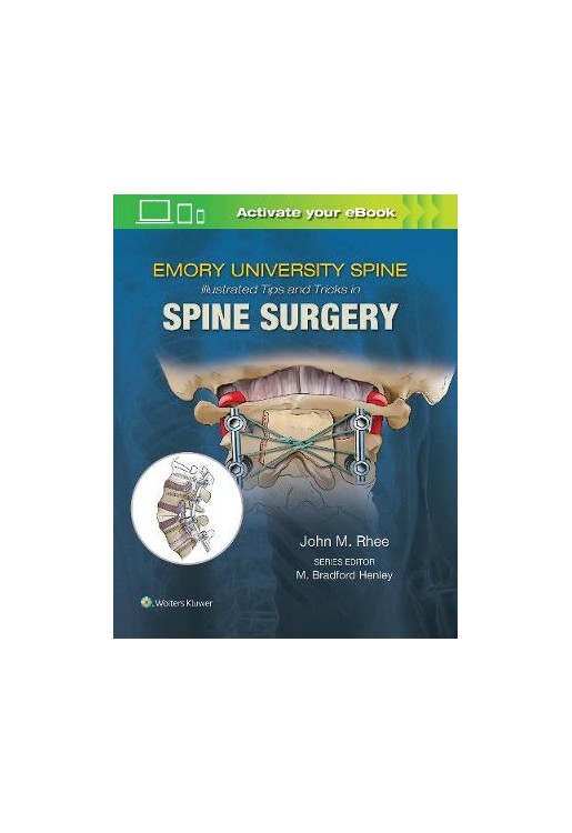 Emory's Illustrated Tips and Tricks in Spine Surgery