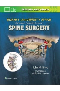 Emory's Illustrated Tips and Tricks in Spine Surgery