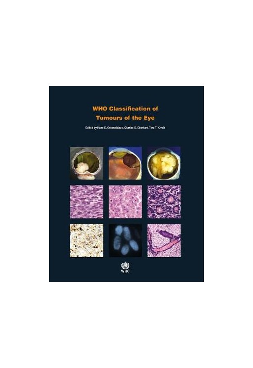 Who Classification of Tumours of the Eye