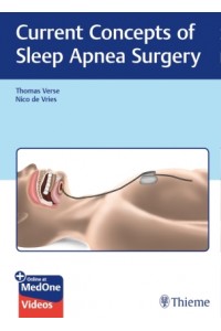 Current Concepts of Sleep Apnea Surgery