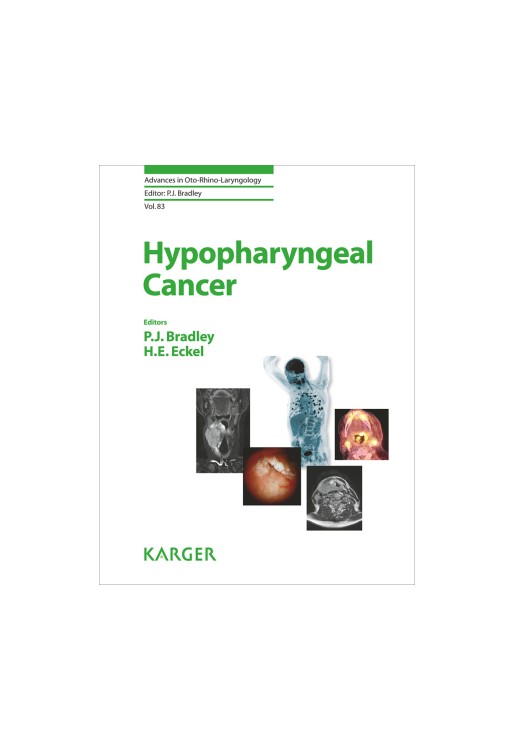 Hypopharyngeal Cancer