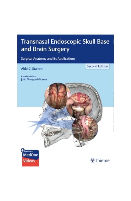 Transnasal Endoscopic Skull...
