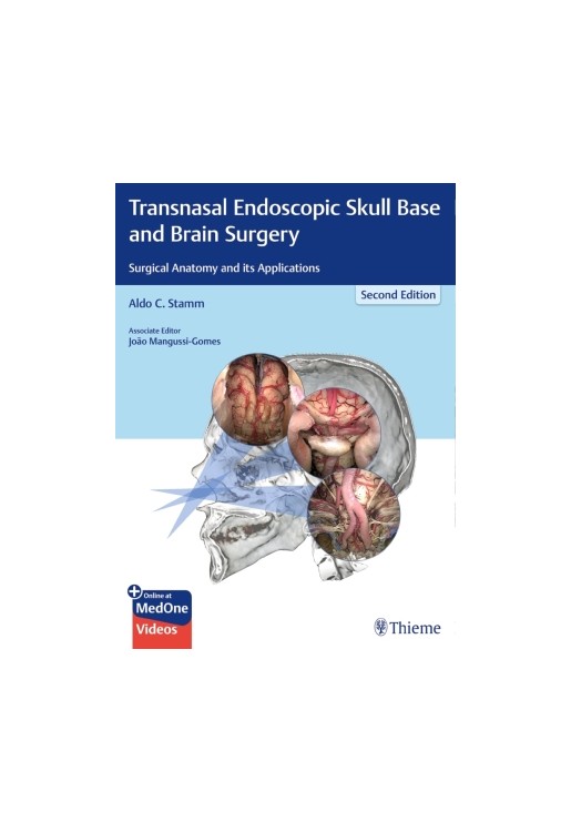 Transnasal Endoscopic Skull Base and Brain Surgery