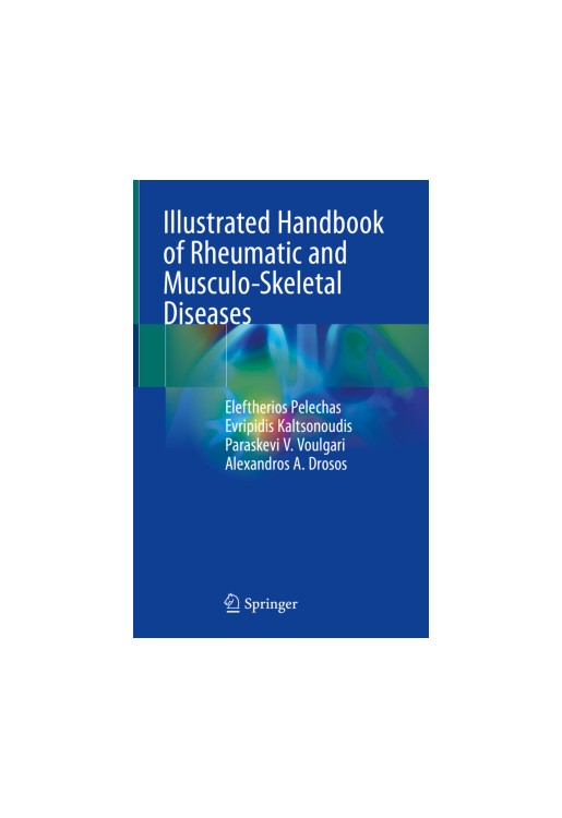 Illustrated Handbook of Rheumatic and Musculo-Skeletal Diseases
