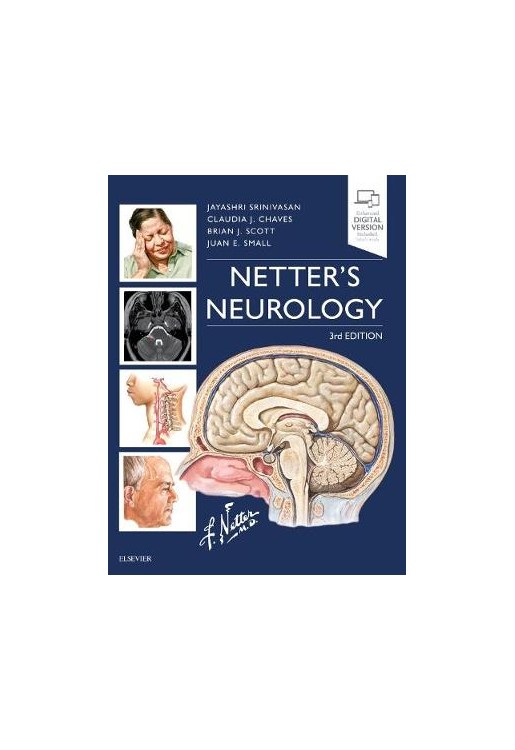 Netter's Neurology