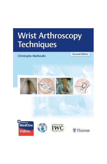 Wrist Arthroscopy Techniques