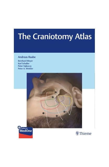 The Craniotomy Atlas