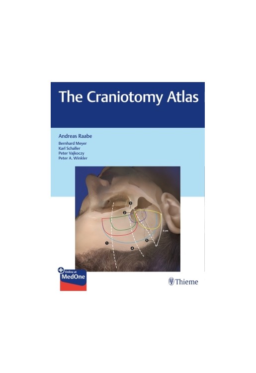 The Craniotomy Atlas
