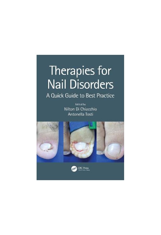 Therapies for Nail Disorders