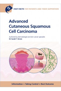 Fast Facts: Advanced Cutaneous Squamous Cell Carcinoma for Patients and their Supporters