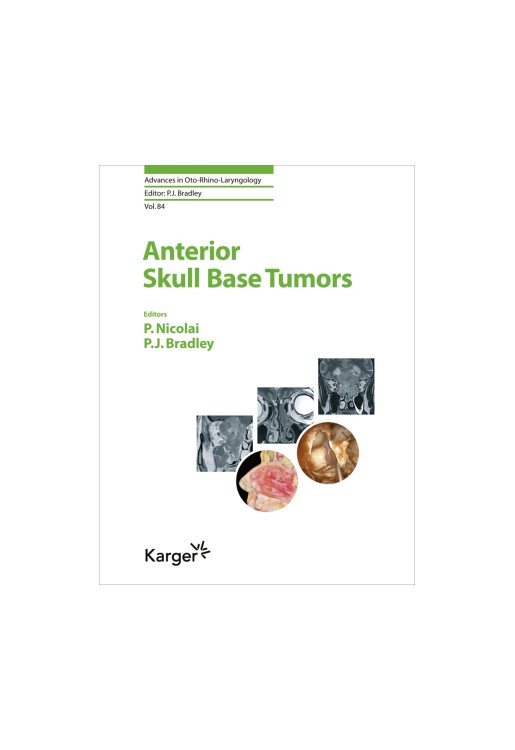 Anterior Skull Base Tumors