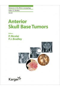 Anterior Skull Base Tumors