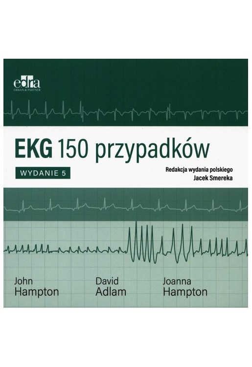 EKG 150 przypadków
