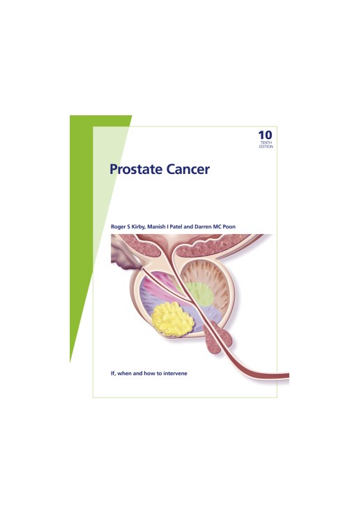 Fast Facts: Prostate Cancer