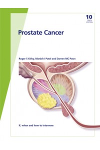 Fast Facts: Prostate Cancer