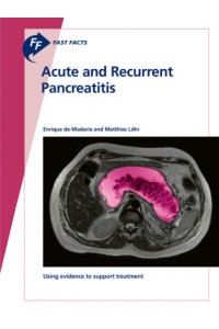 Fast Facts: Acute and Recurrent Pancreatitis