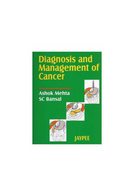 Diagnosis &  Management of Cancer