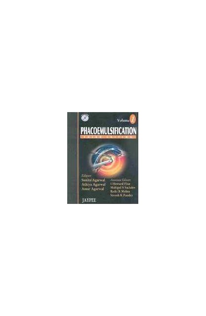 Phacoemulsification 2 vols