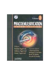 Phacoemulsification 2 vols