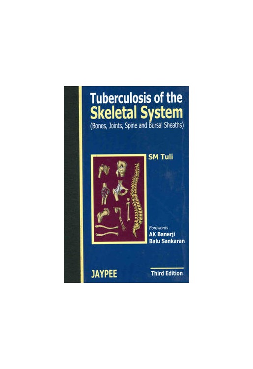 Tuberculosis of the Skeletal System 3E