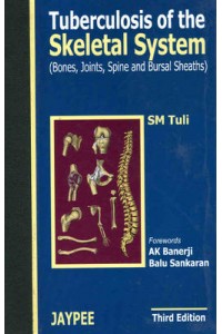 Tuberculosis of the Skeletal System 3E