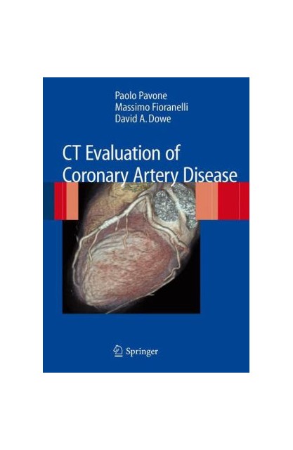 CT Evaluation of Coronary...