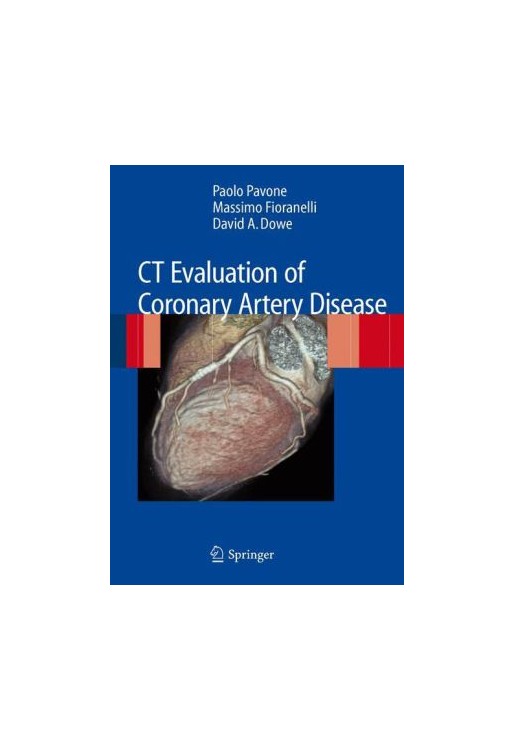 CT Evaluation of Coronary Artery Disease