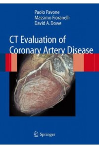 CT Evaluation of Coronary Artery Disease