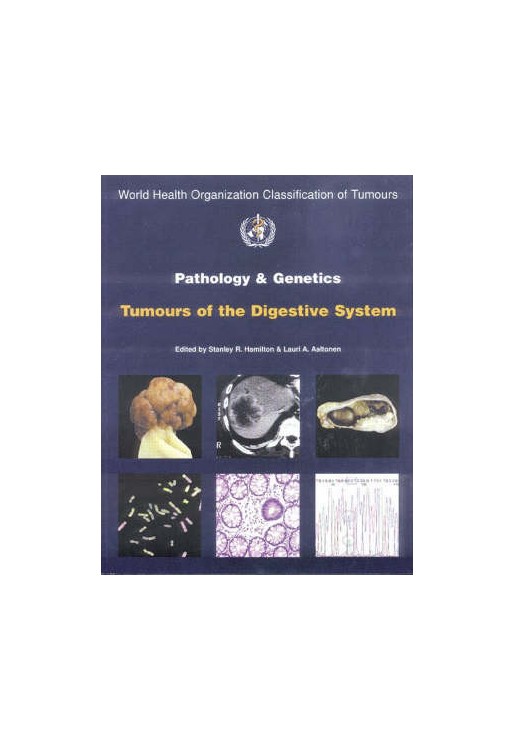 Pathology & Genetics of Tumours of Digestive System