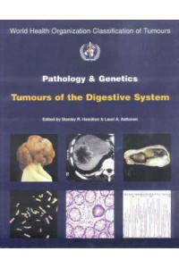 Pathology & Genetics of Tumours of Digestive System