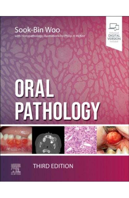 Oral Pathology
