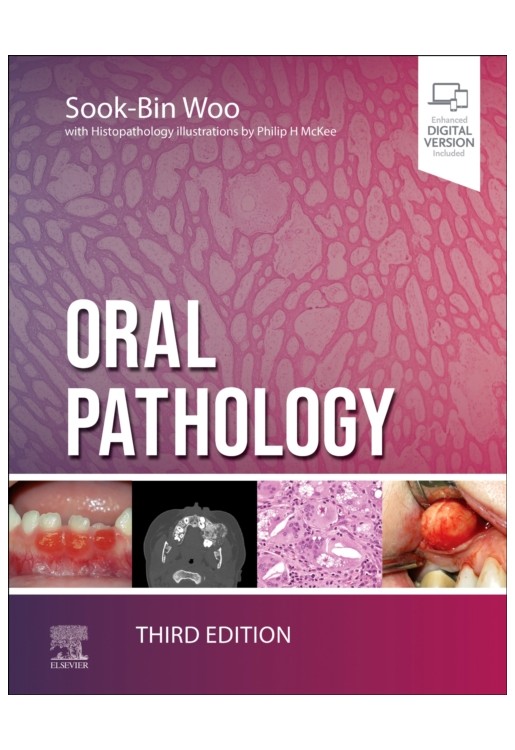 Oral Pathology