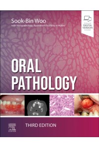 Oral Pathology
